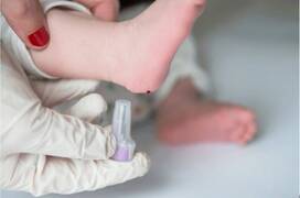 ¿Qué es la prueba del talón en recién nacidos y cuándo se hace?