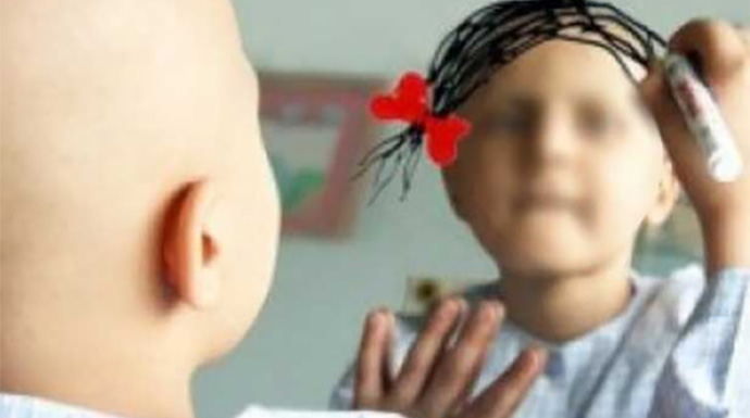 Los niños sufren más este tipo de cáncer que los adolescentes o los adultos. 
