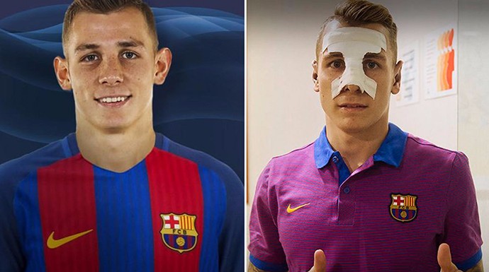 Llegó a Barcelona con un aparatoso vendaje en el rostro.