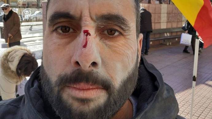 El militante de Vox atacado en Zaragoza y golpeado con un extintor