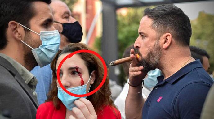 Abascal, fumándose un puro frente a los manifestantes. Abajo, la diputada herida