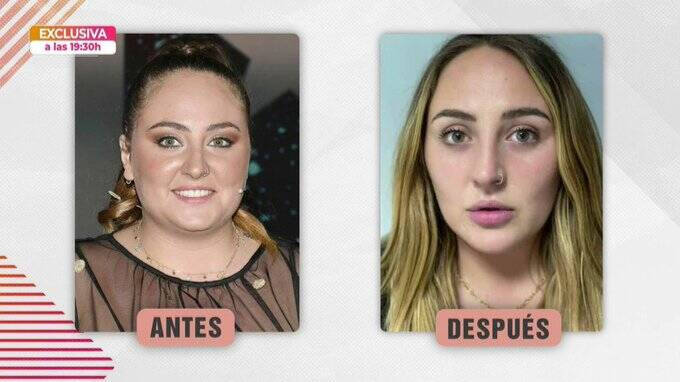 El antes y el después de Rocío Flores Carrasco.
