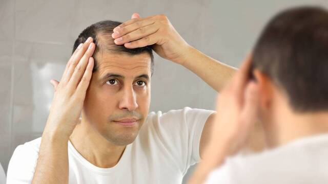 Si tienes problemas de caída del cabello, mejor consulta con un experto