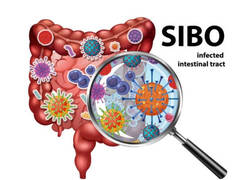 ¿Qué es el SIBO y cómo Identificarlo? Conoce los signos y síntomas clave.