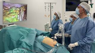 Realizan con éxito una cirugía laparoscópica con rayos infrarrojos a una paciente que tenía un colon de casi cinco metros