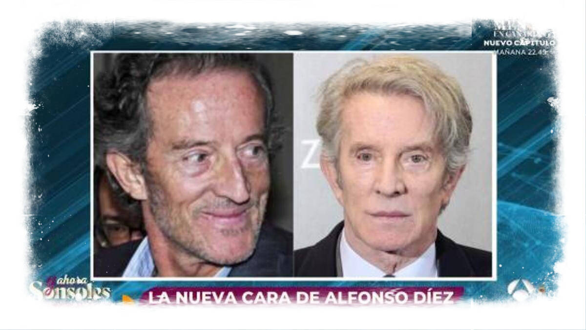 Alfonso Díez: el antes y el después.